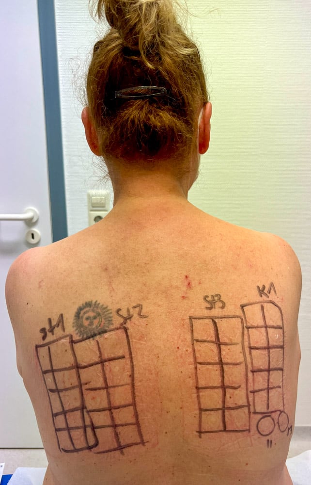 Durch Corona in die Wechseljahre katapultiert, vaginale Entzündungen und am Ende war's das Klopapier - mein Erfahrungsbericht 1 Erfahrungsbericht Corona, Wechseljahre, vaginale Entzündungen, Allergie, Klopapier
