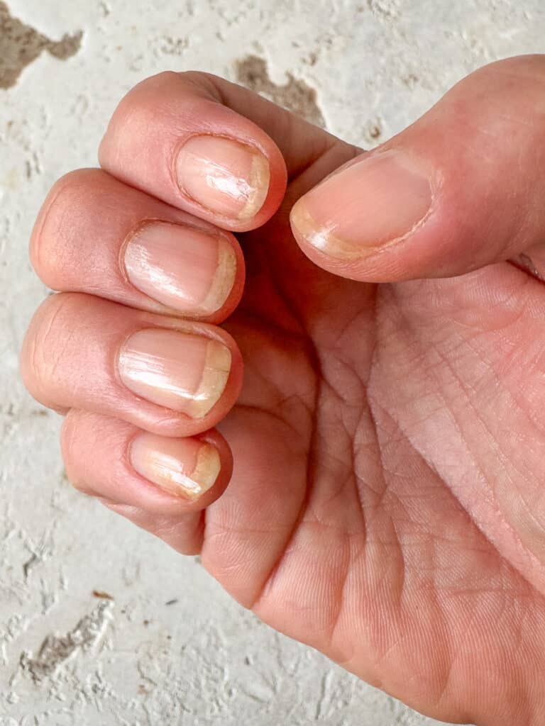 Mein Glycin-Erfahrungsbericht – so überraschend hat es auf Haut, Haare & mehr gewirkt 4 Mein Glycin-Erfahrungsbericht